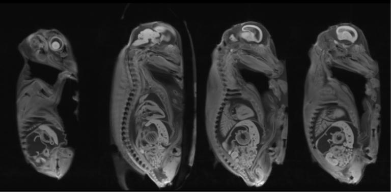 MRI gradient echo image