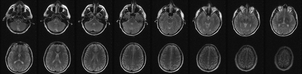 MRI axial brain image