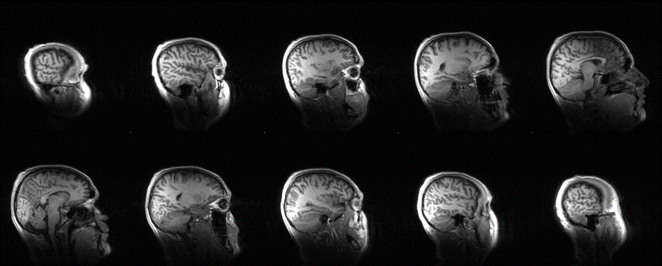 MRI saggital brain image