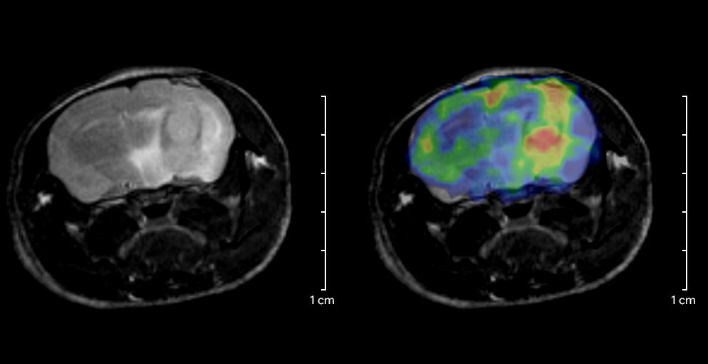 PET-MRI application